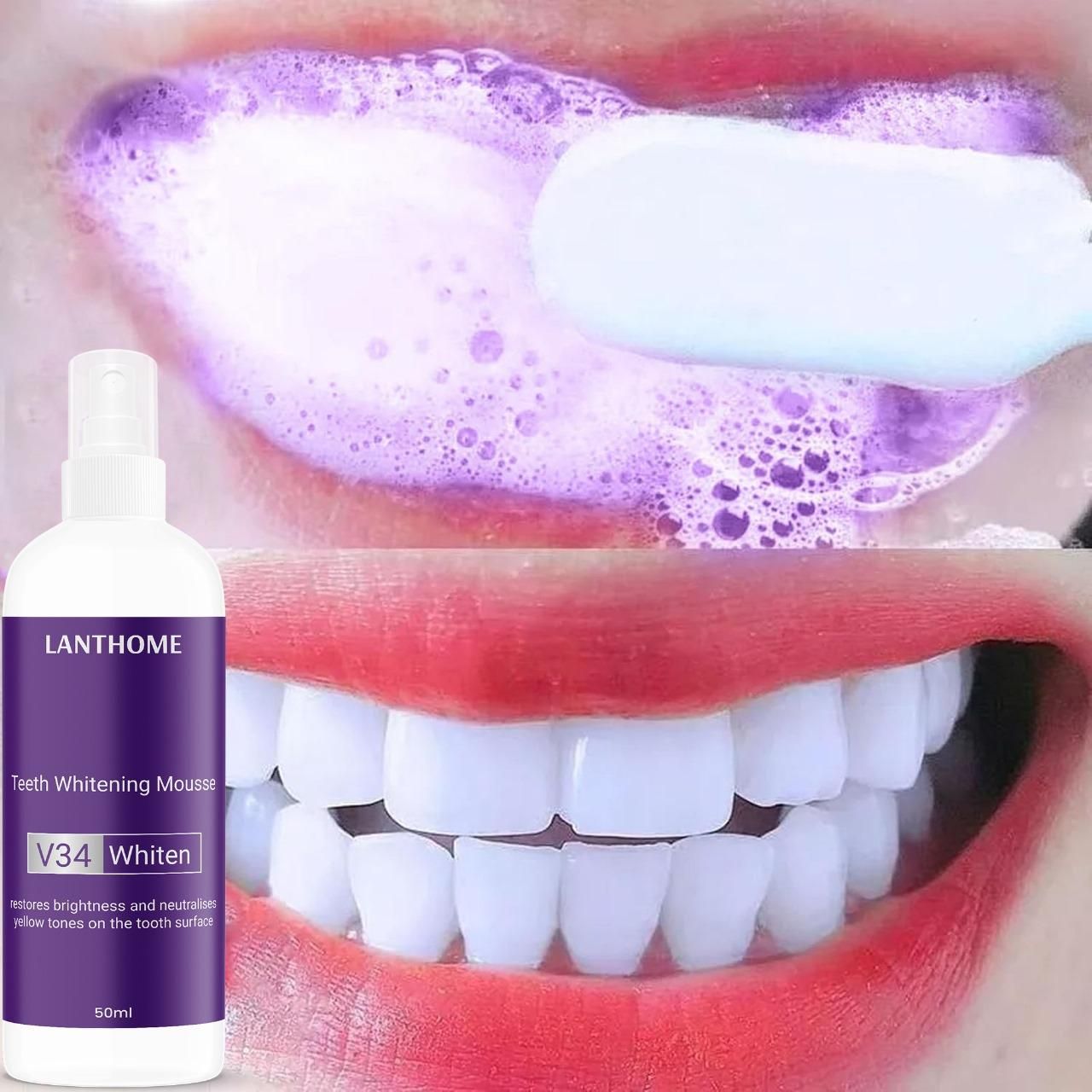 Lanthome Teeth Whitening Spray V34