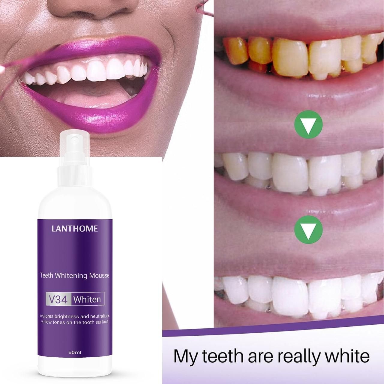 Lanthome Teeth Whitening Spray V34