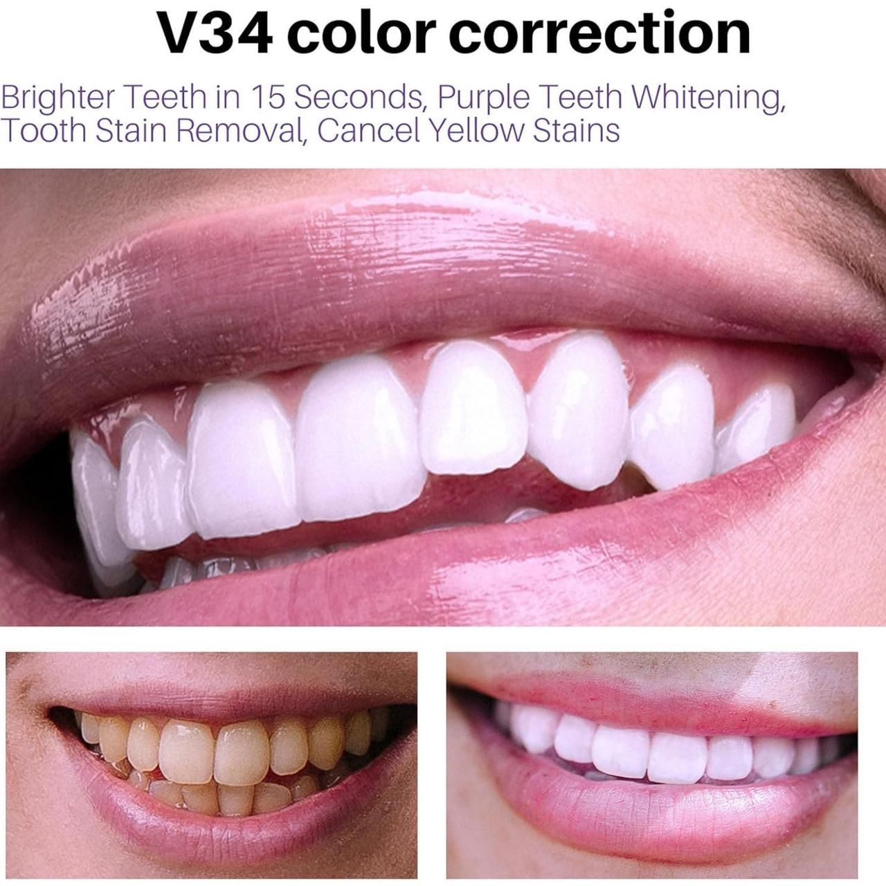 Lanthome Teeth Whitening Spray V34